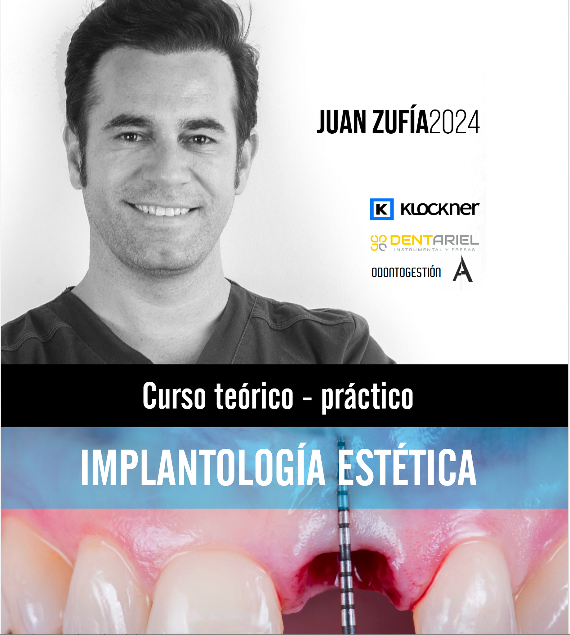 Curso Teórico-Práctico Implantología Estética