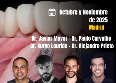 Curso Modular de Implantología Estética Inmediata