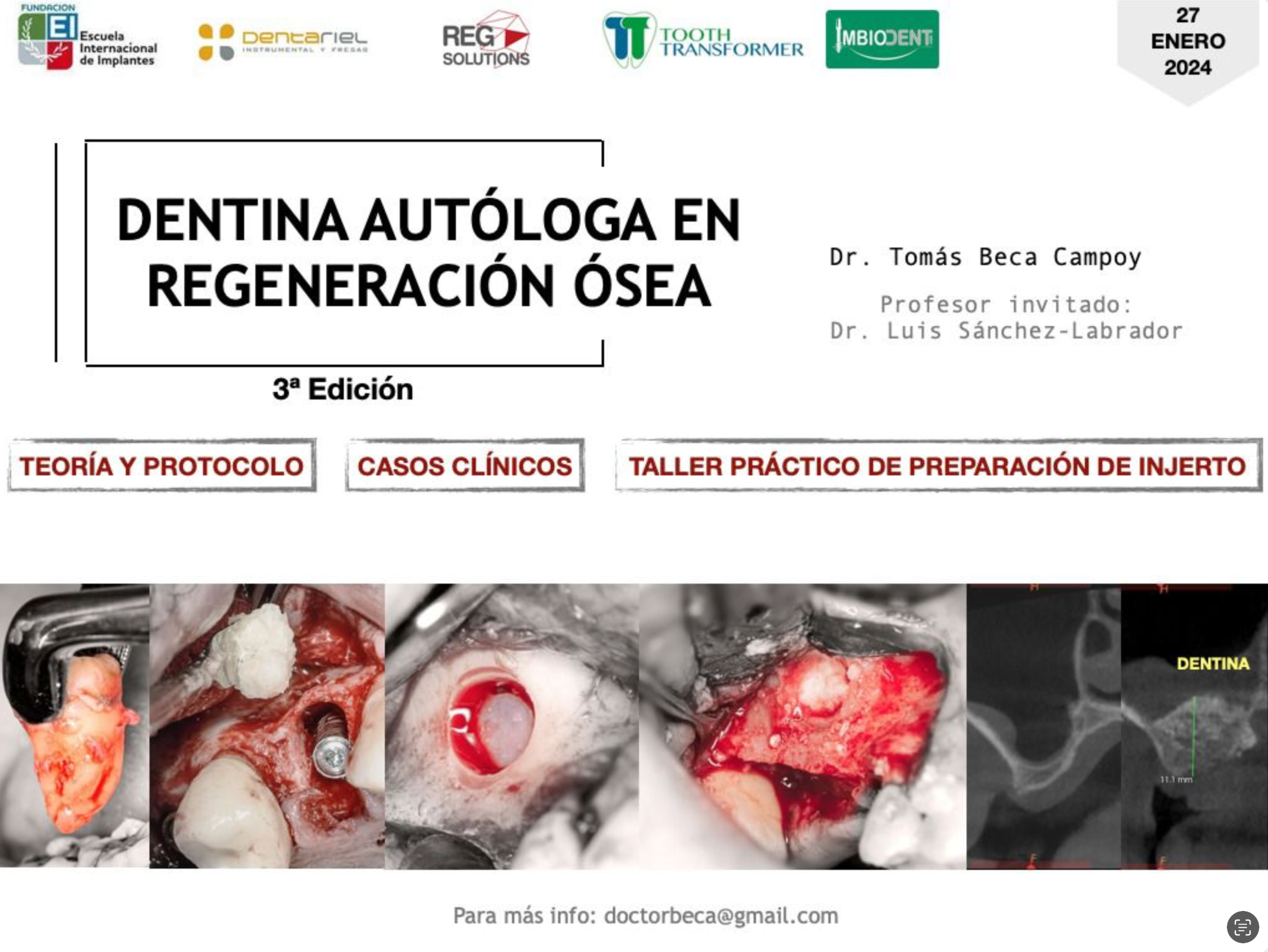 Curso 'Dentina autóloga en regeneración ósea'