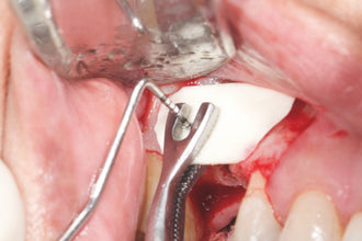 Pinza Howard Gluckman