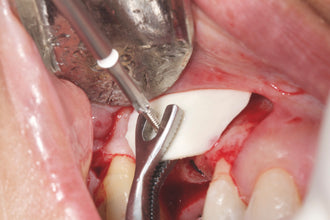 Pinza Howard Gluckman