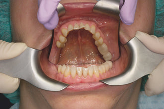 Retractor fotográfico acero